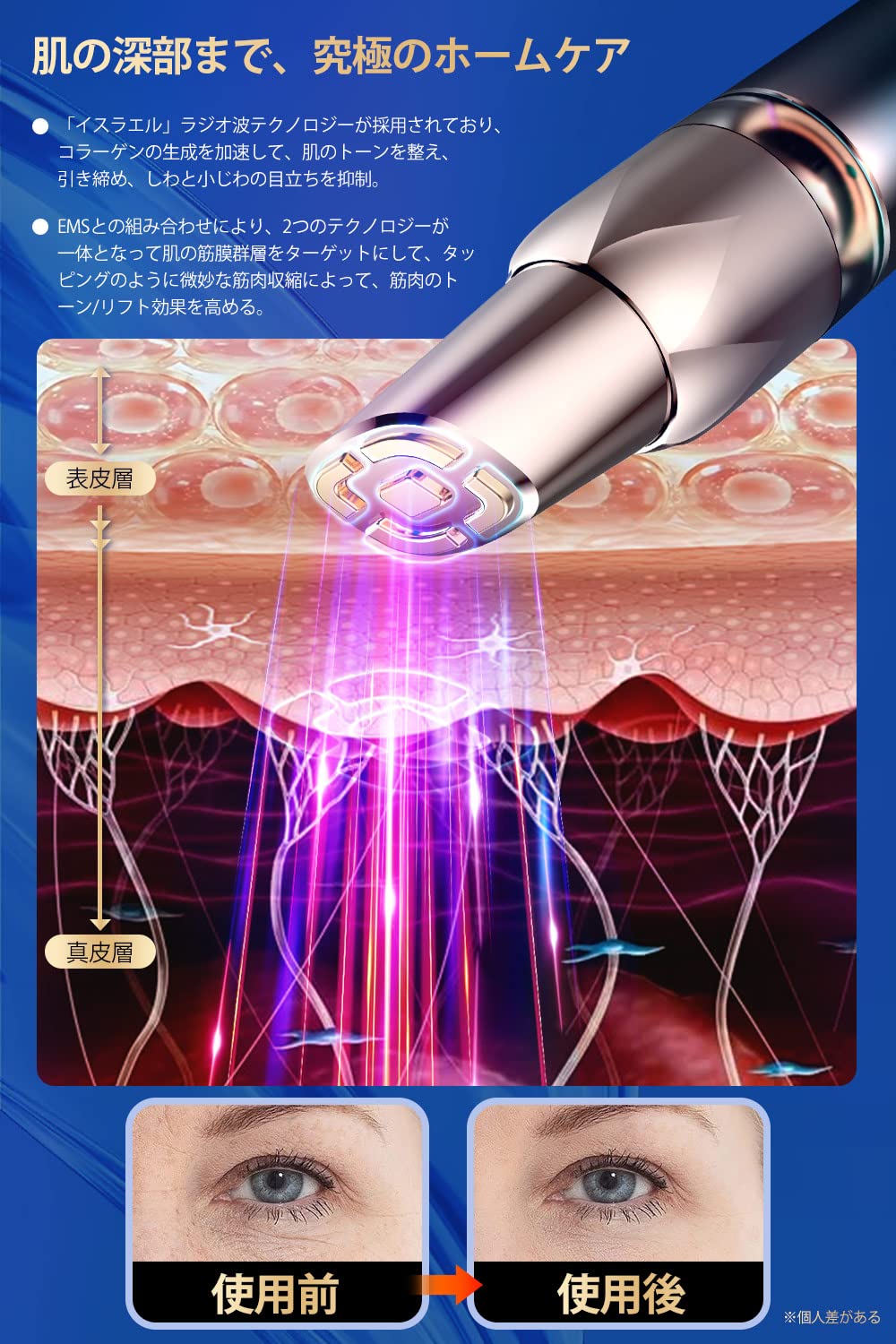 Amazon.co.jp: 目元美顔器 3in1目元ケア RF美顔器 引き締め 美顔器EMS 