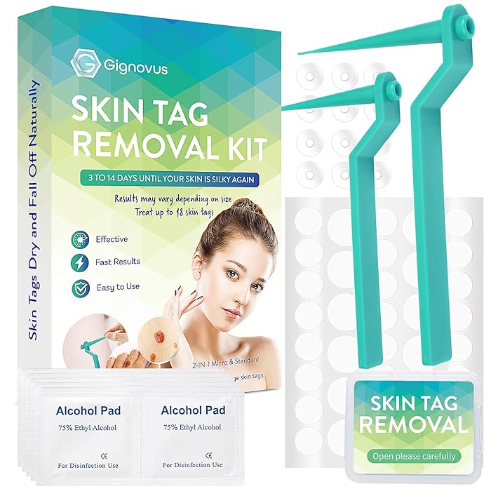 Buy Gignovus Skin Tag Removal Kit (2in1), Effective and Safe Skin Tag