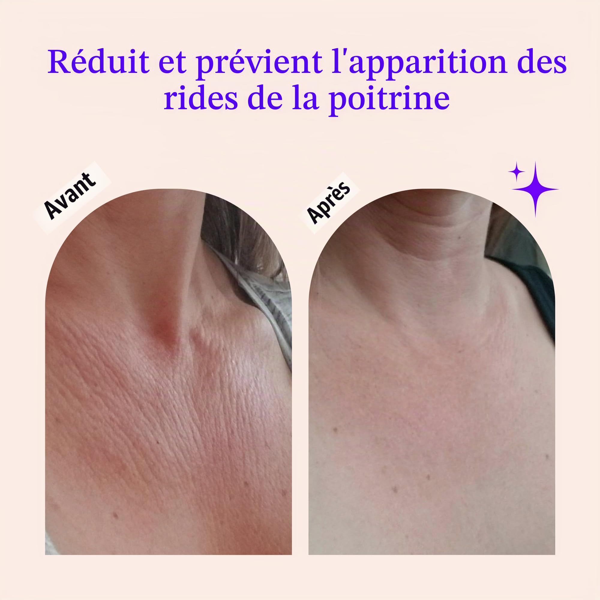 Patchs Anti Rides Réutilisables Pour Décolleté - Pour Une Peau Plus Lisse, Jeune & Radieuse - Traitement anti-âge pour raffermir, resserrer et hydrater - Cou et Décolleté, Femme & Homme (2 mois)
