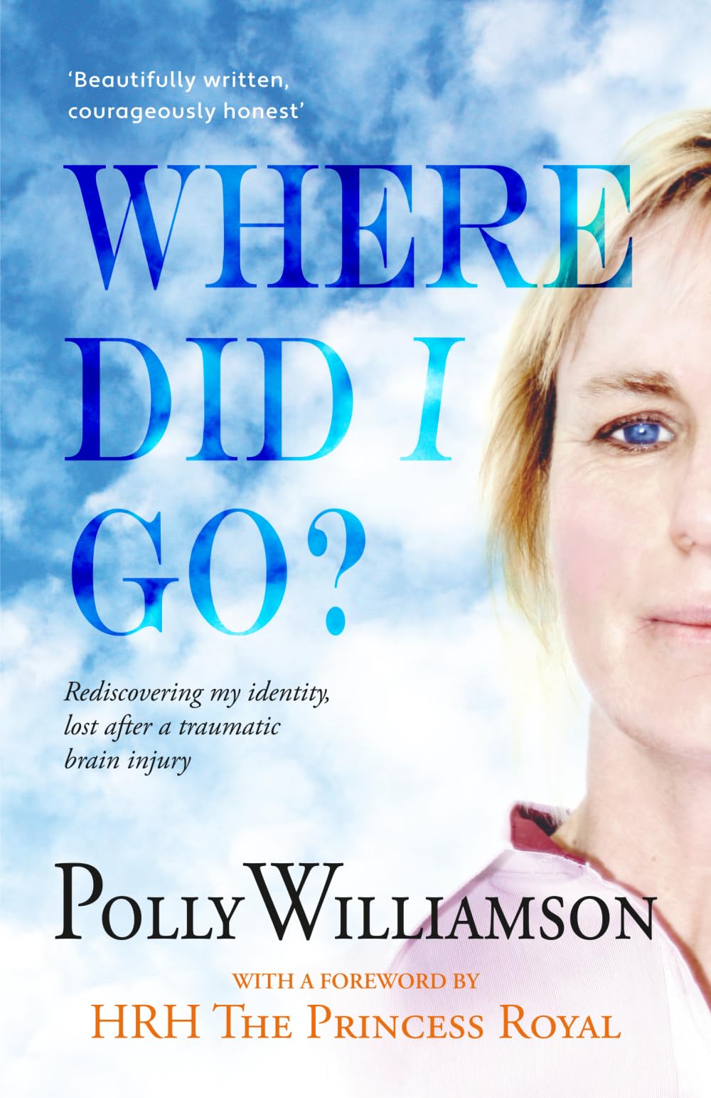 Where did I go?: Rediscovering My Identity, Lost After a Traumatic Brain Injury (Crumps Barn Studio Personal Memoir)