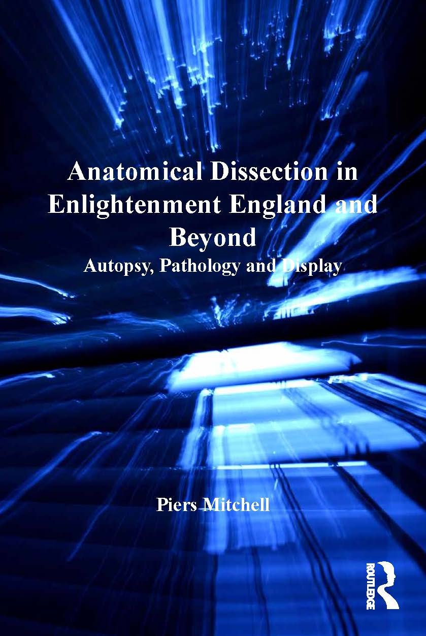 Anatomical Dissection in Enlightenment England and Beyond: Autopsy, Pathology and Display      1st Edition, Kindle Edition
