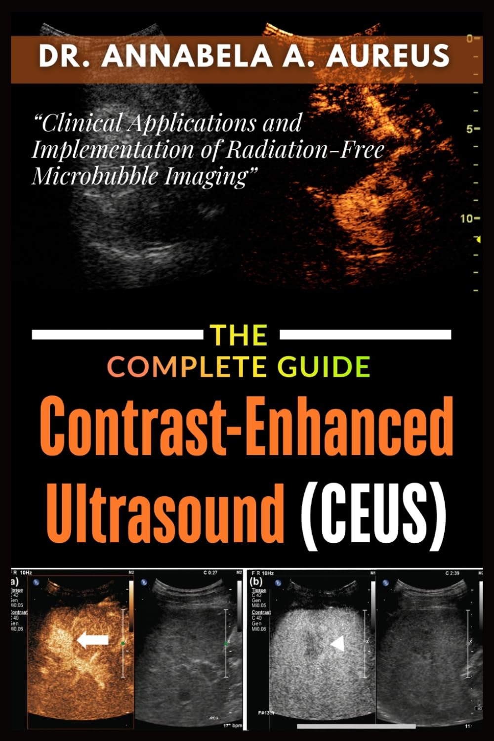 Contrast-Enhanced Ultrasound (CEUS): The Complete Guide: Clinical Applications and Implementation of Radiation-Free Microbubble Imaging (The Ultrasound Mastery Series)