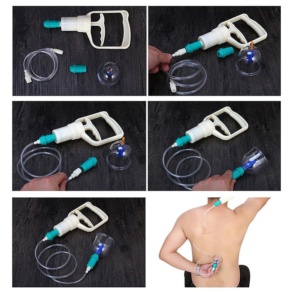 FOOJo 24-Cup-Vakuum-Schröpfset, professionelle chinesische Schröpftherapie, traditionelles chinesisches Schröpf-Massage-Set