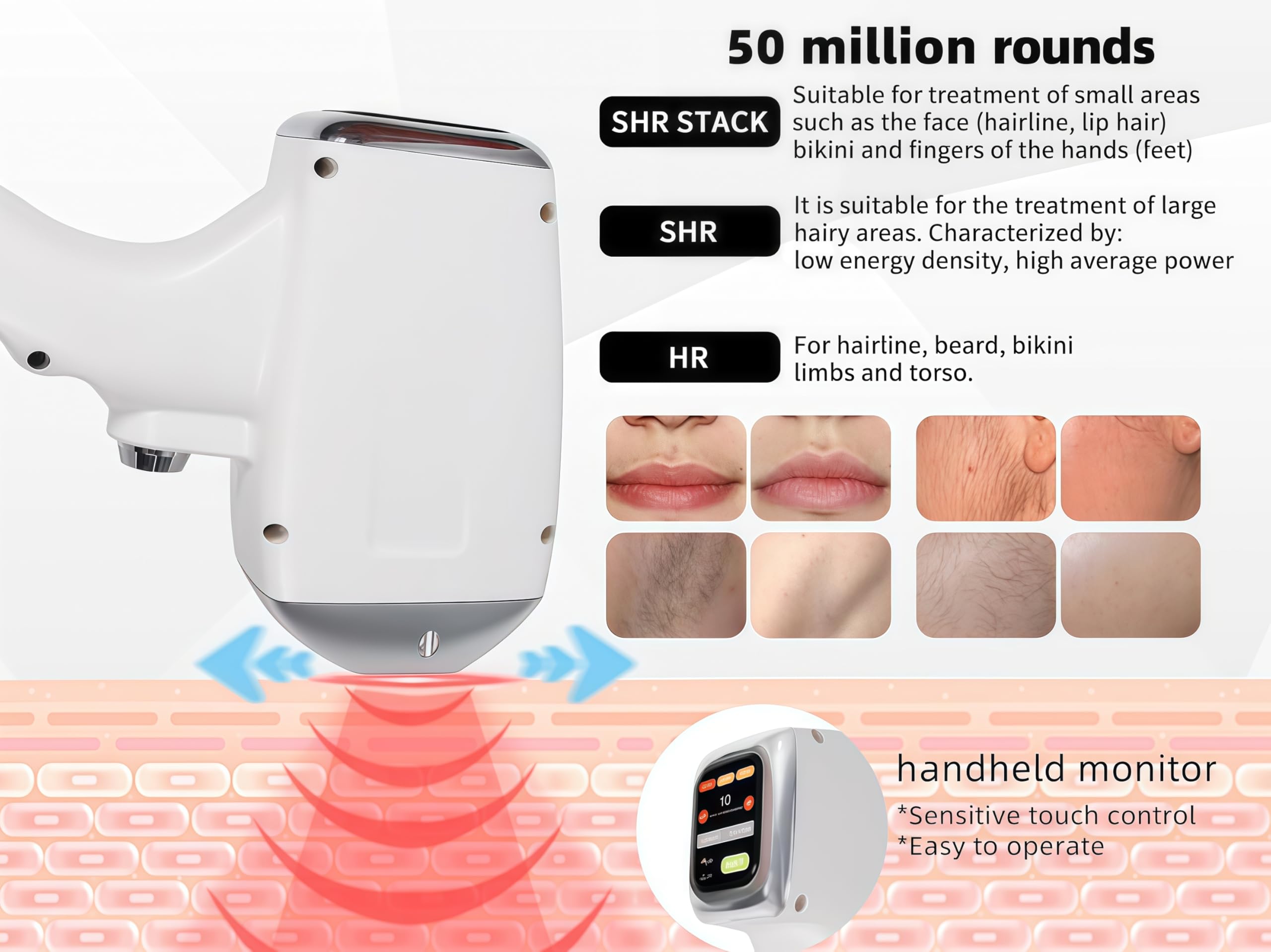 4000W Ice Titanium Professional 808 Diode Laser Body Removal Machine 4 Wave grande schermo di alta energia di depilazione permanente