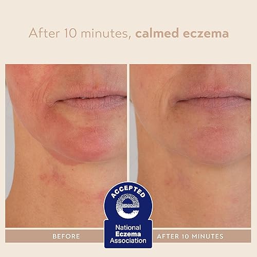 Miniatura 7 de SHANI DARDEN SKINCARE - Mascarilla facial nutritiva exclusiva, una máscara hidratante de arcilla de bentonita para calmar el enrojecimiento y la