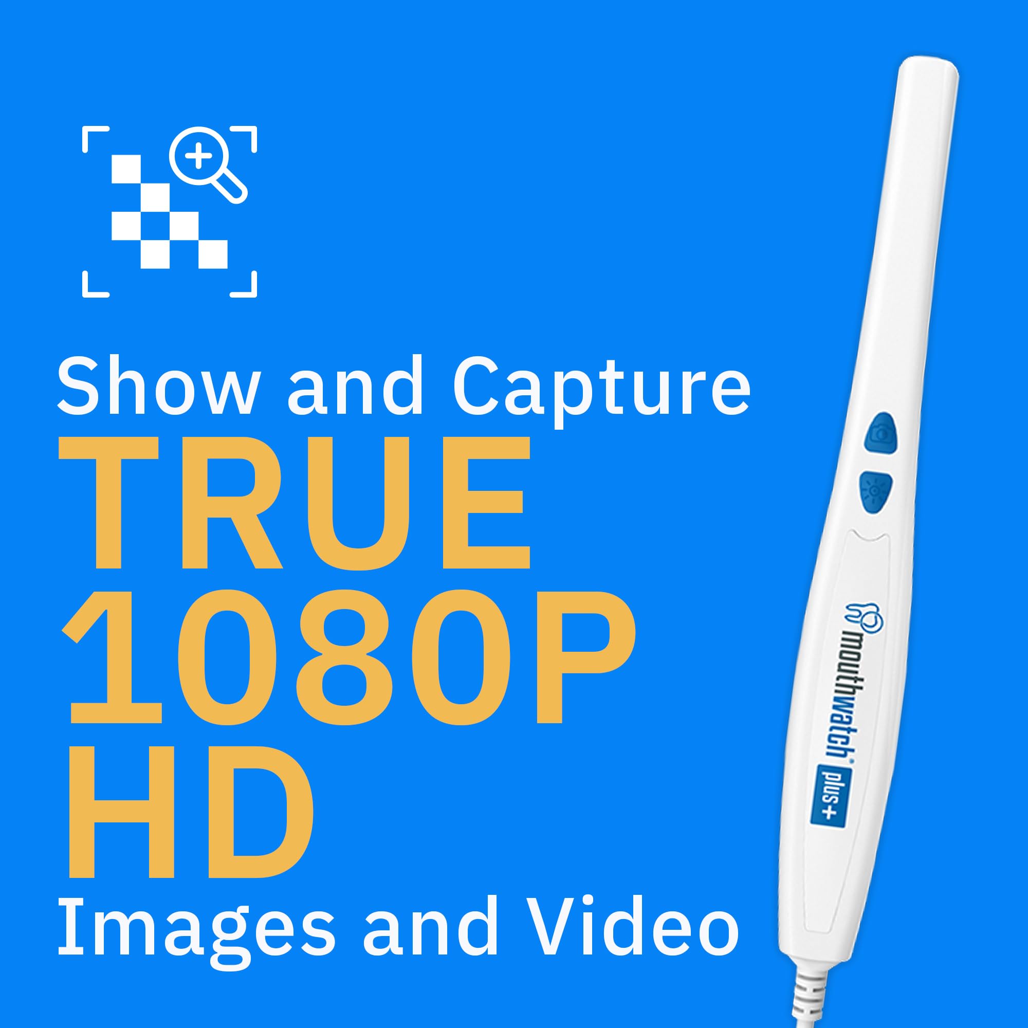 MouthWatch Intraoral Camera, Crystal Clear Images with an Easy to Use, Fast, Single Button Operation Dental Camera, Compatible with Over 50 Dental Imaging Suites, Lightweight and Ergonomic, 31 Grams: HD