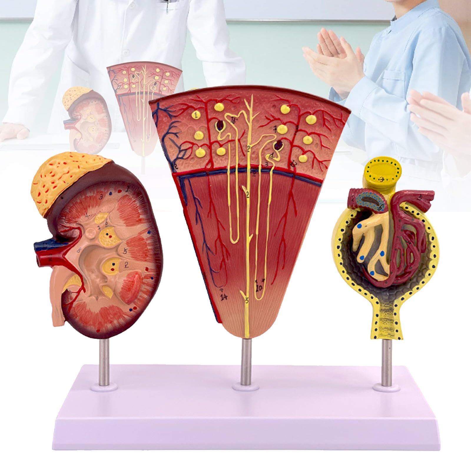 Human Kidney, Nephron and Glomerulus Model, Anatomy for Medical Education, Suitable for Assisted Dissection