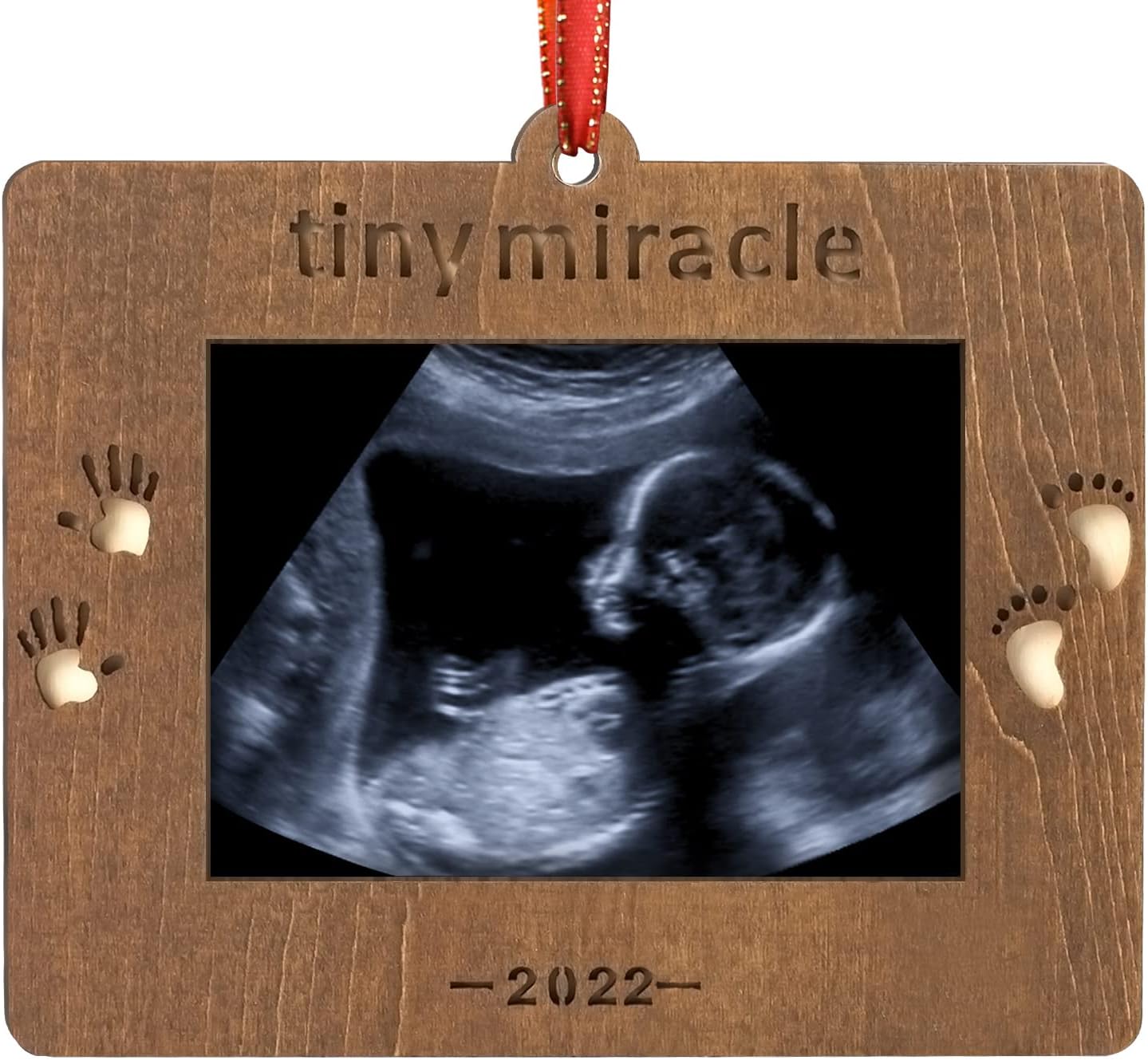 Miracle Of Christmas 2022 Amazon.com: Creawoo 2022 Tiny Miracle Christmas Keepsake Ornament Sonogram  Picture Frame Ultrasound Photo Frame Idea Xmas Gift For Expecting Parents  And Grandparents, Wooden Christmas Tree Decoration : Baby