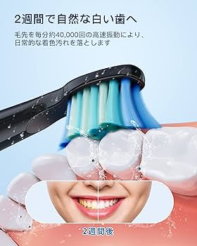 電動歯ブラシ Amazon.co.jp: 電動歯ブラシ Bryxze 電動はぶらし 音波歯ブラシ