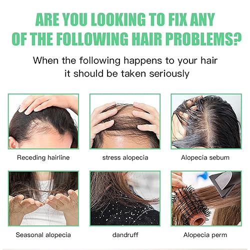 Miniatura 2 de Aceite de romero para el crecimiento del cabello orgánico, 100% puro aceite orgánico para cabello rizado dañado, aceites esenciales de romero para