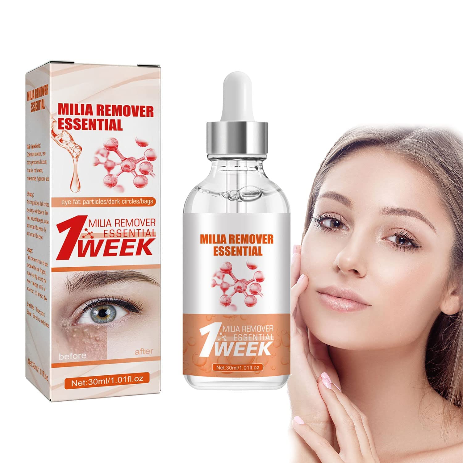 Buy 3PCS Speedy Milia Remover, Milia Remover Milia Spot , Helps