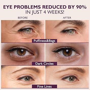 2Pcs Caffeine Eye Stick Under Eye Cream