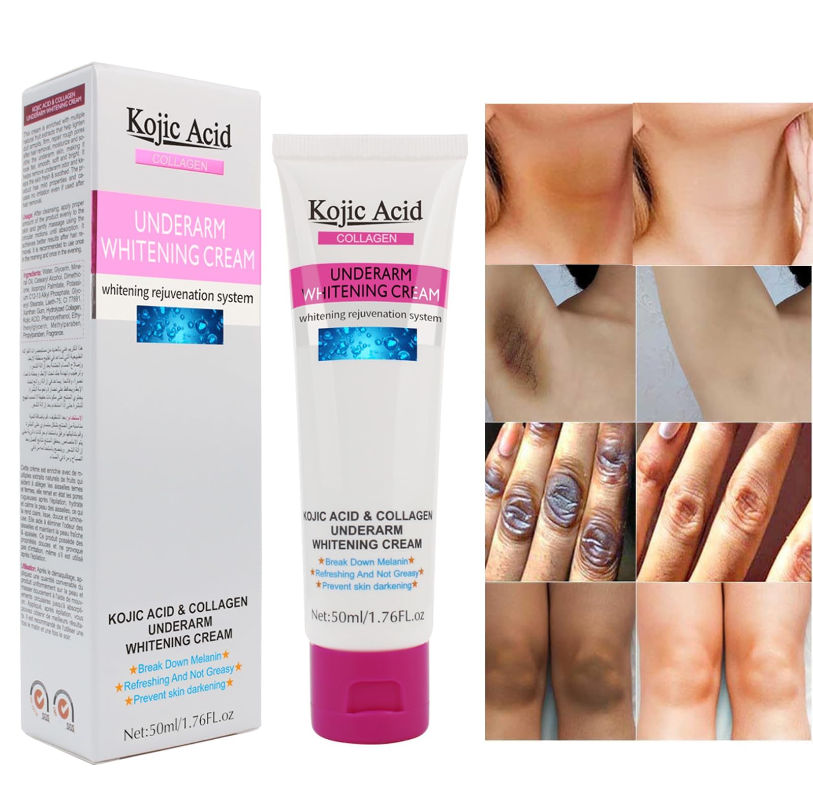 Excefore Acid Skin Whitening Cream for Intimate Area, Dark Spot Corrector for Body, Skin Bleaching Cream for Private Area, Underarms, Knees, Elbows, Bikini Line, Armpit, Dark Spot Remover, 1.7oz