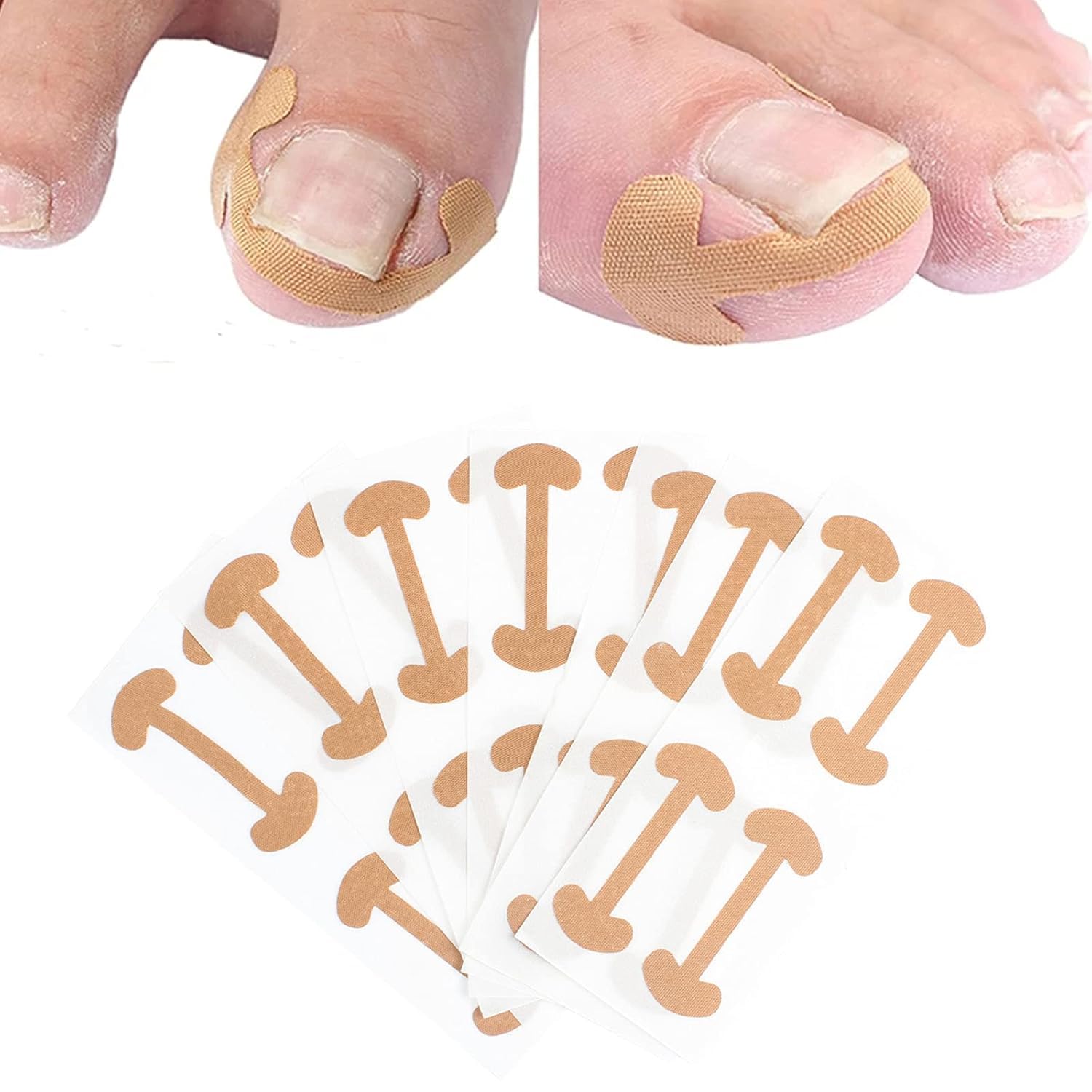 tupermar 5 pcs ingrown toenail corrector stickers breathable self-adhesive elastic toenail correction patch for toenail treatment fingernail care protect toe nail