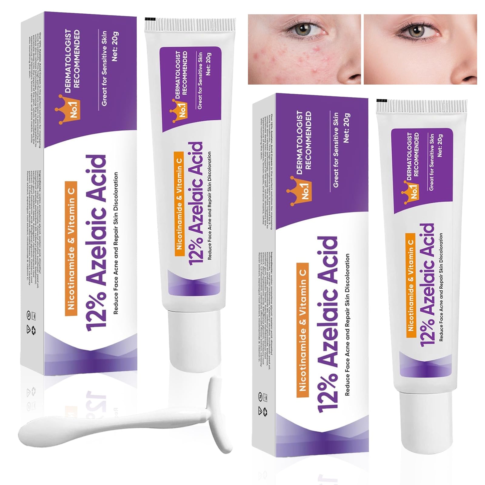 12%-Azelaiksaure-Serum 2 Stück, 20g für Empfindliche Haut, Pickel- und Rötungshymi, enthalten 1 Massagestab