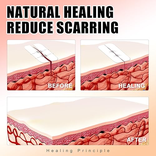 Miniatura 4 de Carbou Tiras de cierre de heridas de emergencia 4 piezas Bandaids de mariposa con puntada con cremallera Kit de cierre de laceración Sin