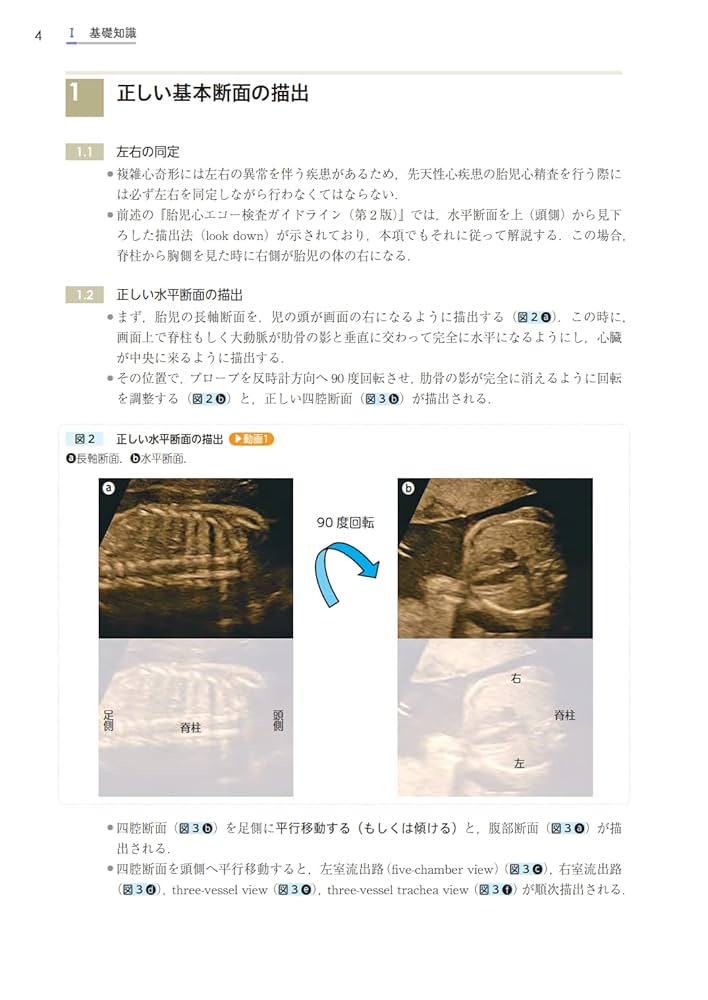 【裁断済】ガイドラインに基づく胎児心エコー テキスト 精査・臨床編 ガイドラインに基づく 胎児心エコーテキスト 精査・臨床編