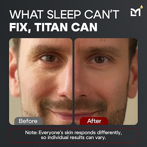 Miniatura 6 de Man Labs Titan - Crema de ojos antienvejecimiento para hombre, tratamiento para ojeras debajo de los ojos, tratamiento de bolsas de ojos para