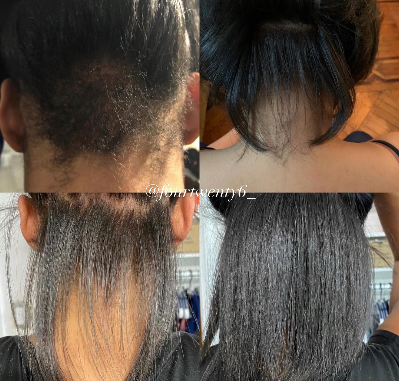 Hair Growth Oil with Rare Batana & Ayurvedic Herbs - Extra Strength Natural Treatment for Thinning Hair Loss, Edges, Scalp Health - Strengthens & Thickens All Hair Types - 30+ Botanicals - 2oz - Image 3