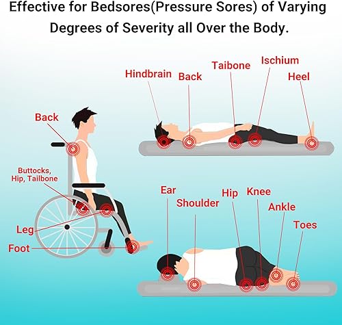 Miniatura 4 de ishancare Crema para el dolor de cama Crema natural rápida y segura para el dolor de presión, ungüento curativo para el cuidado de heridas por