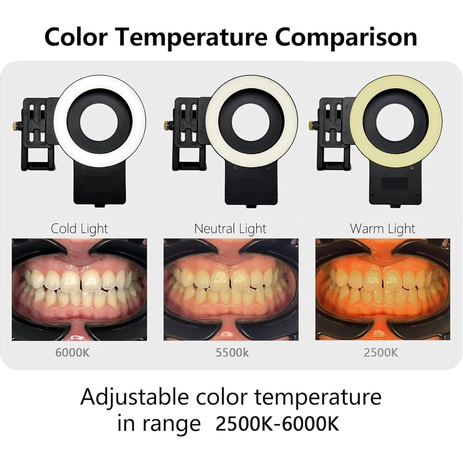 Ringlicht für zahnärztliche Fotografie mit 3 Modi und Farbtemperatur, 2500 K-6000 K, hocheffiziente Oralassistenzlampe für professionelle Fotoqualität