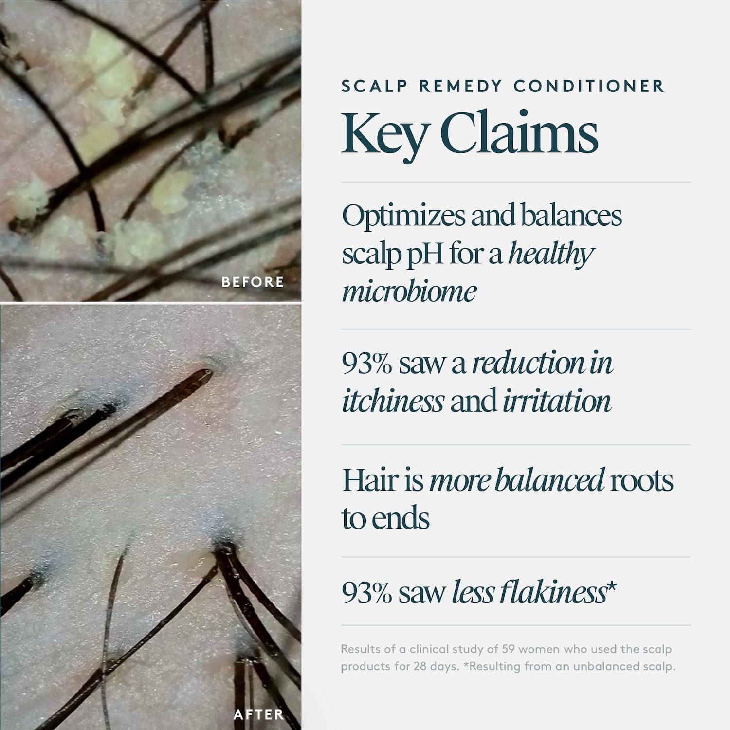 VIRTUE Scalp Remedy Conditioner, Microbiome Balancing for Dry, Oily, and Irritated Scalps, Fragrance Free, Safe for All Hair Types, Color Safe, 6.7 Fl Oz - Image 6