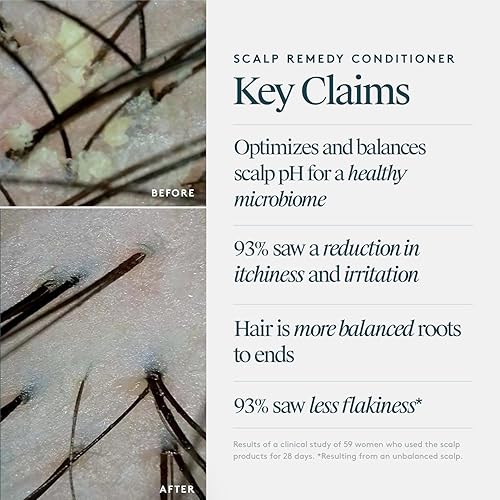 Miniatura 6 de VIRTUE Acondicionador remedio para el cuero cabelludo, equilibrio de microbiomas para cuero cabelludo seco, graso e irritado, sin fragancia, seguro