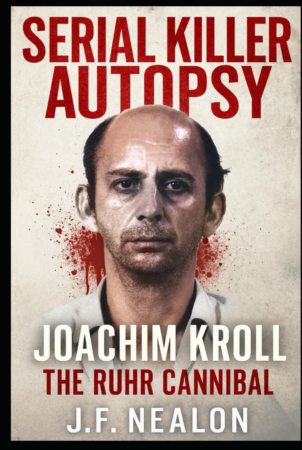 Serial Killer Autopsy: Joachim Kroll, The Ruhr Cannibal