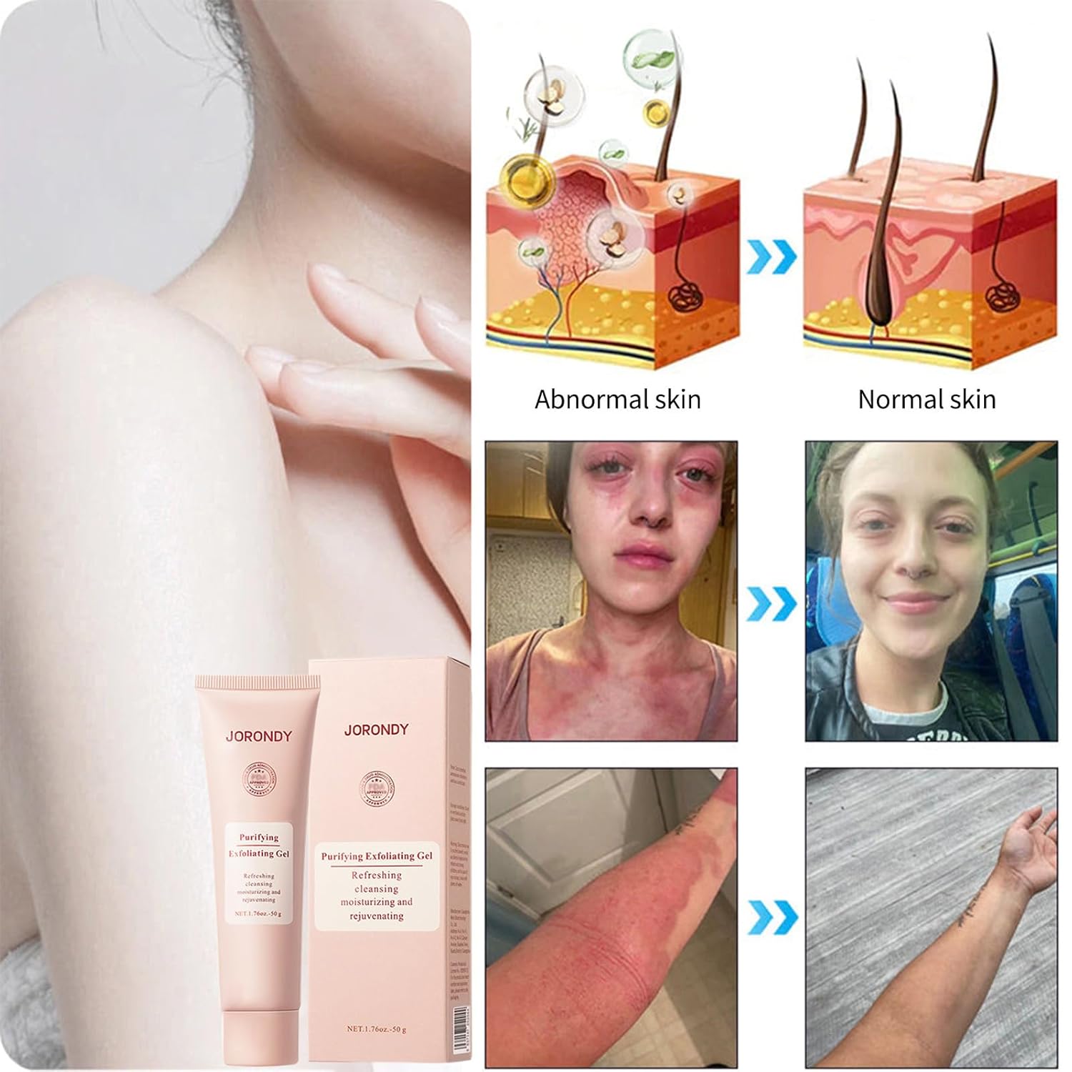 JORONDY Purifying Exfoliating Gel, JORONDY Purifying Enzymes Exfoliating Gel, Deep Cleansing and Moisturizing Formula for All Skin Types (4 Pack)