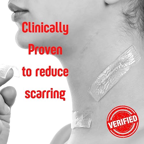 Vista 13 de SilverSeal - Apósito para quemaduras y heridas, almohadillas de hidrogel con X-Static Silver, calmantes, húmedas y protectoras para quemaduras