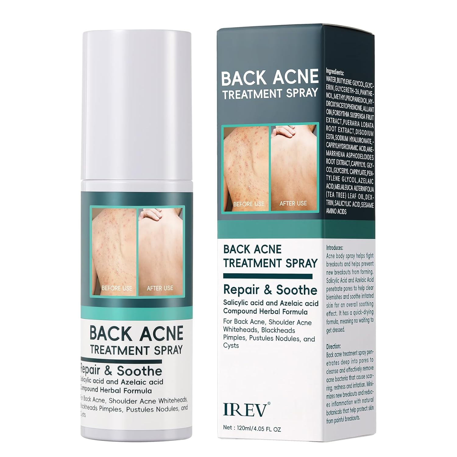 Back Acne Spray Salicylic Acid Spray Body Acne Spray, Back