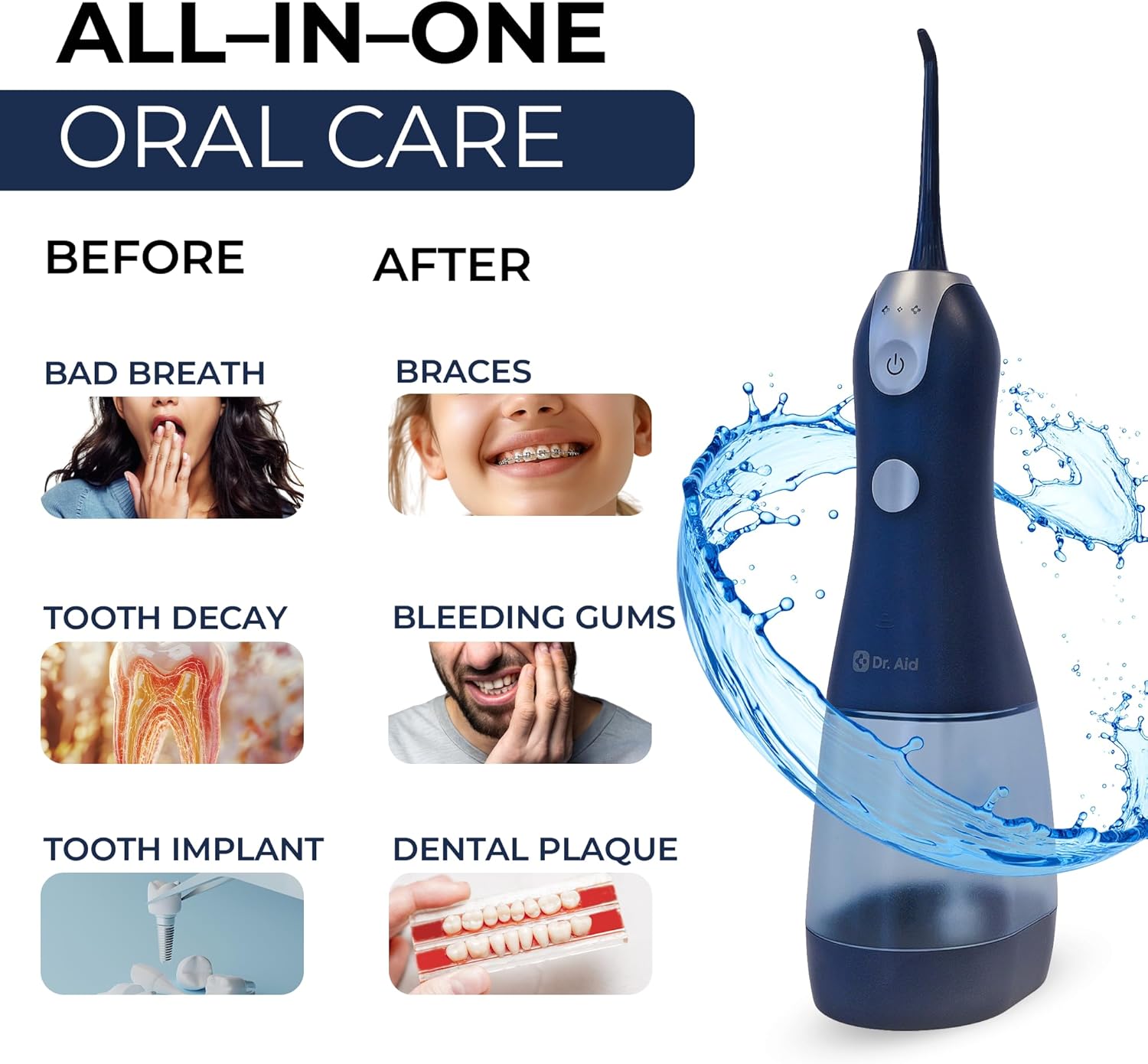 Dr. Aid Portable Water Flosser - Dental Oral Irrigator for Travel with 11Oz Tank, Filter, 5 Tips, Magnetic Charger- IPX8 Waterproof Electric Flosser - Water Flossers for Teeth, Gums, Braces- Dark Blue