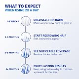 Men's Rogaine 5% Minoxidil Foam for Hair Regrowth, Topical Hair Loss Treatment for Men to Regrow Fuller, Thicker Hair, Unscented Minoxidil Topical Aerosol, 1-Month Supply, 2.11 oz