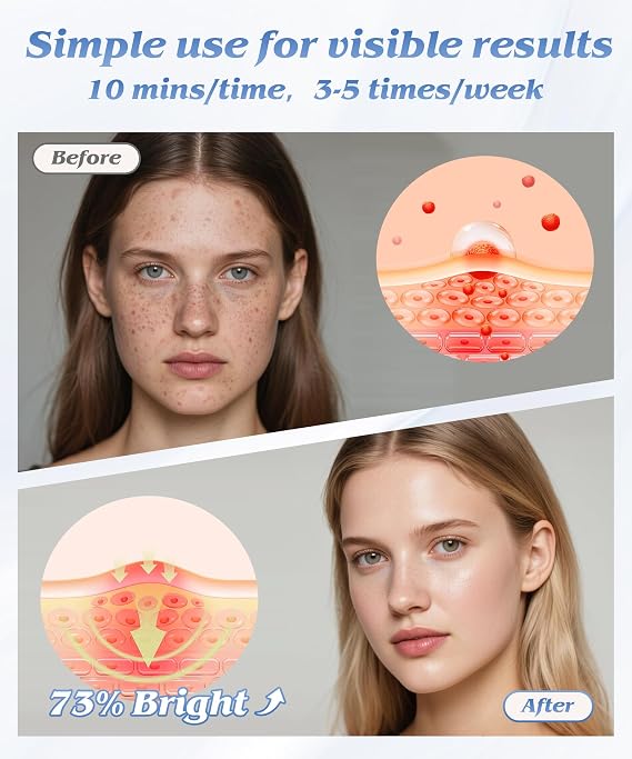 EVFOFO Red Light Therapy for Face, Light Therapy Mask for Firming, Wrinkles & Acne, Wireless Red & 850nm Infrared Light Silicone Mask, 7-Color LED Face Mask Portable for Use at Home & Travel, Black