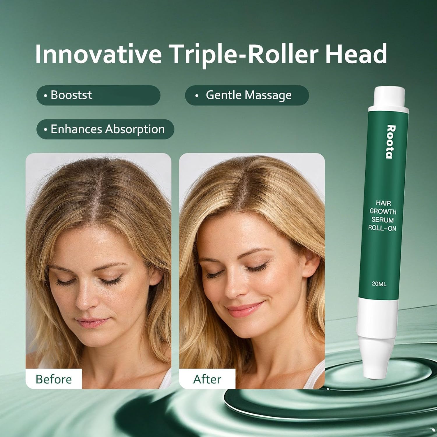 Roota Hair Growth Serum Roll-On, Roota Hair Revival Serum, Nourishes Scalp for Thicker, Healthy Hair, 25ml