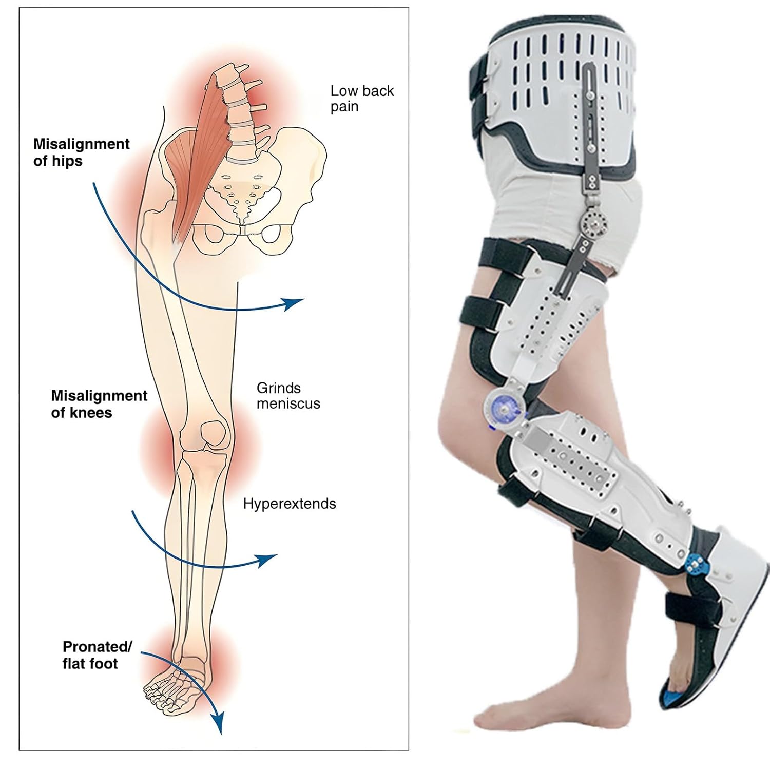 Adjustable Leg Straightening Brace-Hip Abduction Full Leg Brace for Walking with Knee Stabilizer, Hip-Knee-Ankle-Foot Orthosis with Walking Boot Postoperative Rehabilitation Equipment
