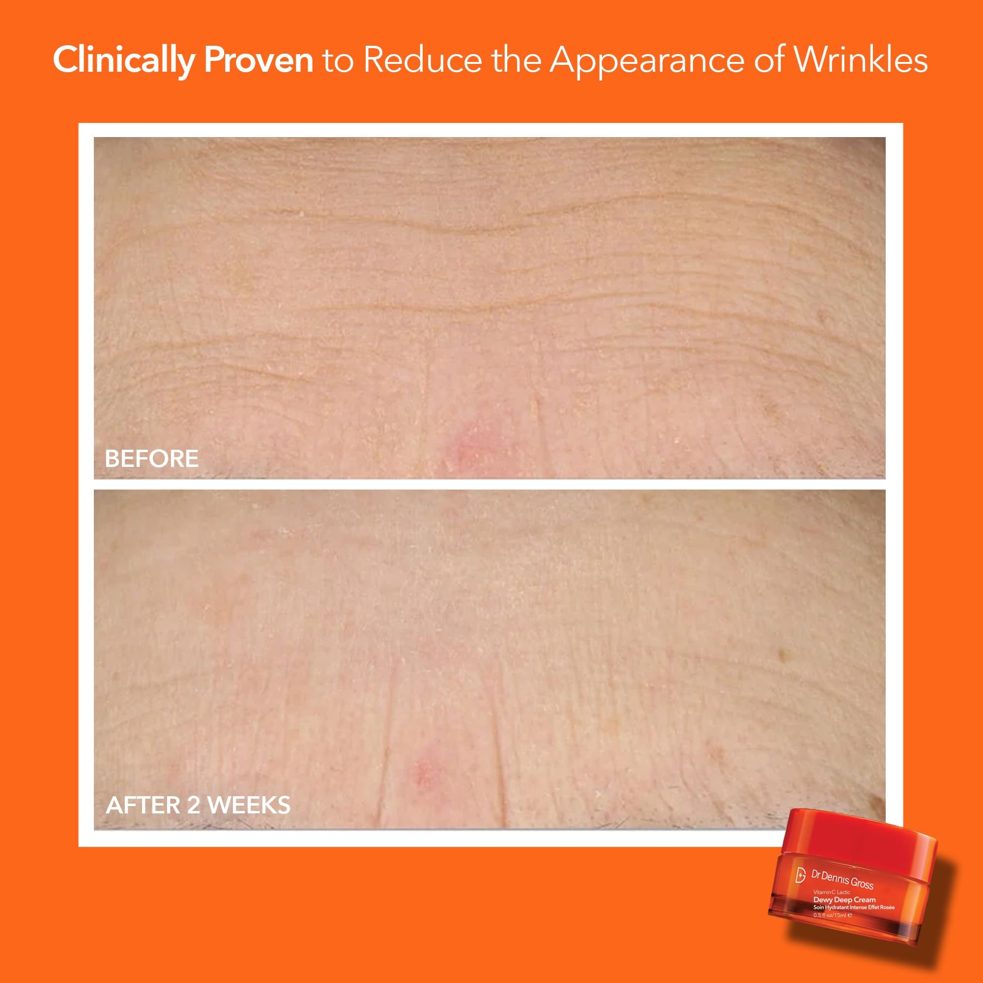Dr Dennis Gross Alpha Beta Universal Daily Peel