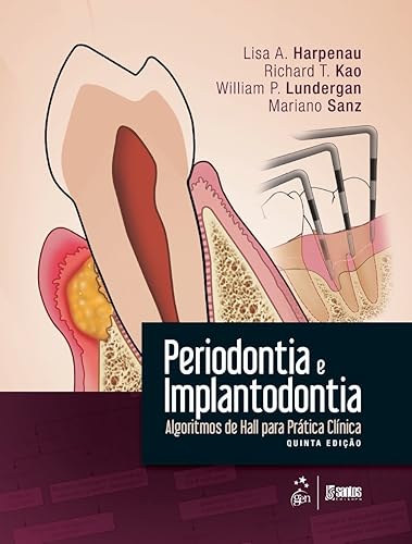 Periodontia e Implantodontia - Algoritmos de Hall para Prática Clínica