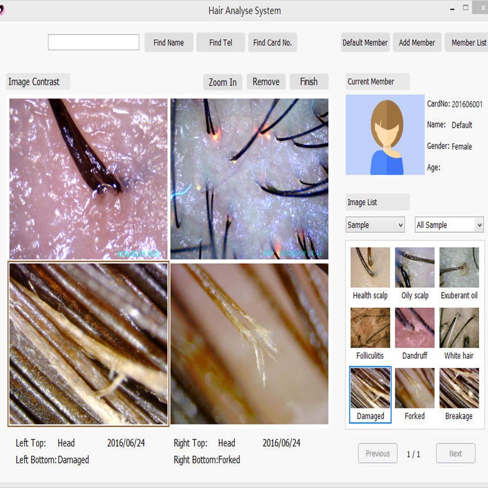Hair Analyzer, Zinnor Hair Analysis Machine 8.0 MP Digital Hair