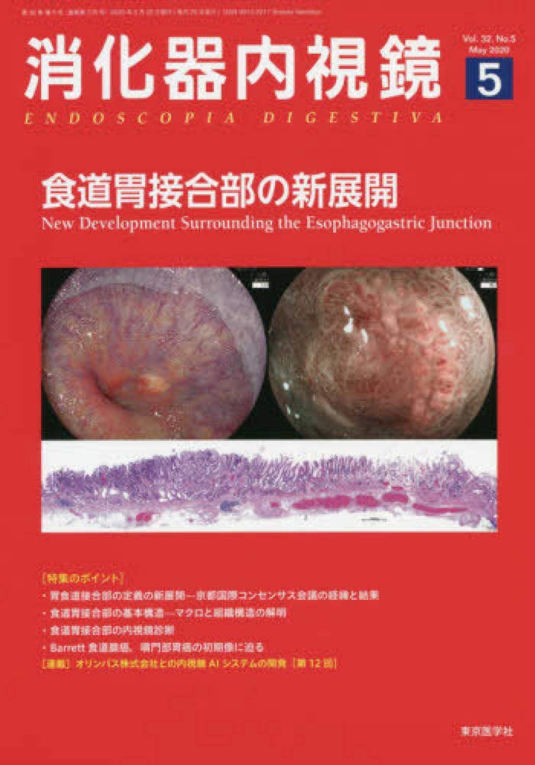Amazon.co.jp: 消化器内視鏡 (Vol.32 No.5(2020 May)) : 消化器内視鏡