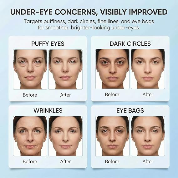 Bio-Collagen Eye Patches 30 PairsUnder Eye Patches for Dark Circles, Puffiness, Fine LinesWith Collagen, Hyaluronic Acid, NiacinamideHydrating, Anti-AgingKorean Skincare