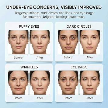 Bio-Collagen Eye Patches 30 PairsUnder Eye Patches for Dark Circles, Puffiness, Fine LinesWith Collagen, Hyaluronic Acid, NiacinamideHydrating, Anti-AgingKorean Skincare