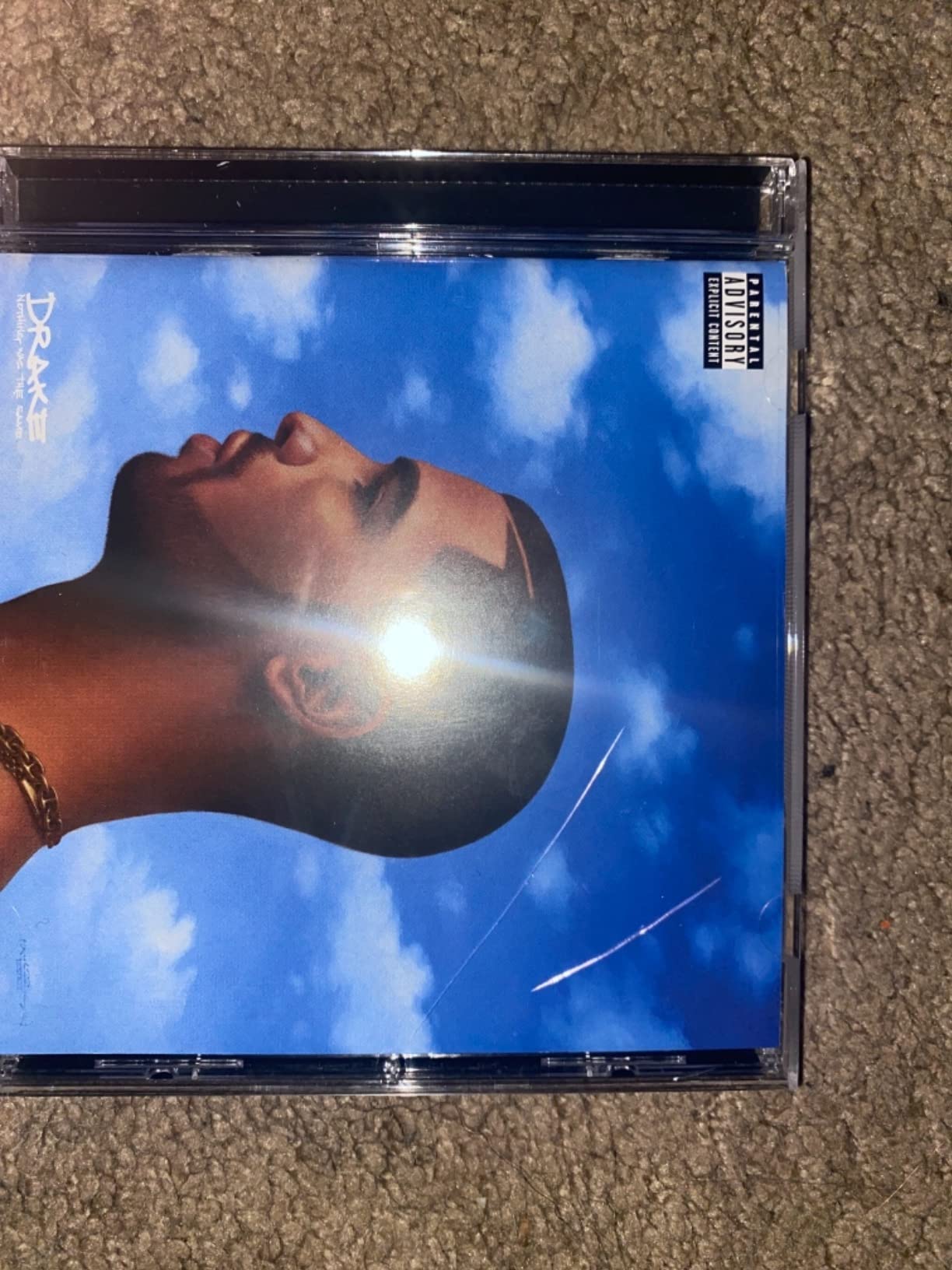 Items case came damaged