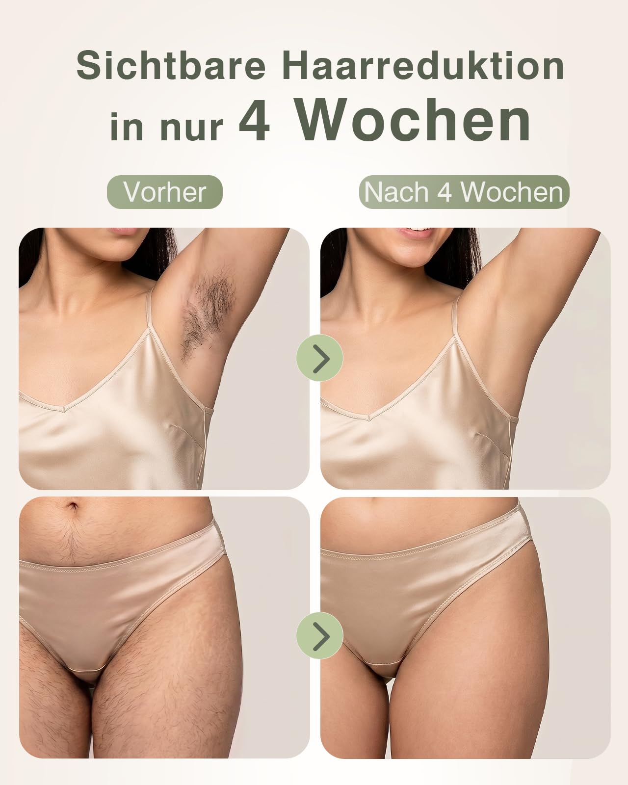 IPL Geräte Haarentfernung 5℃ Eiskühlkontakt Schmerzfreie Haarentfernungsgerät 86% Haarreduktion Körper Gesicht Bikini Achseln Beine