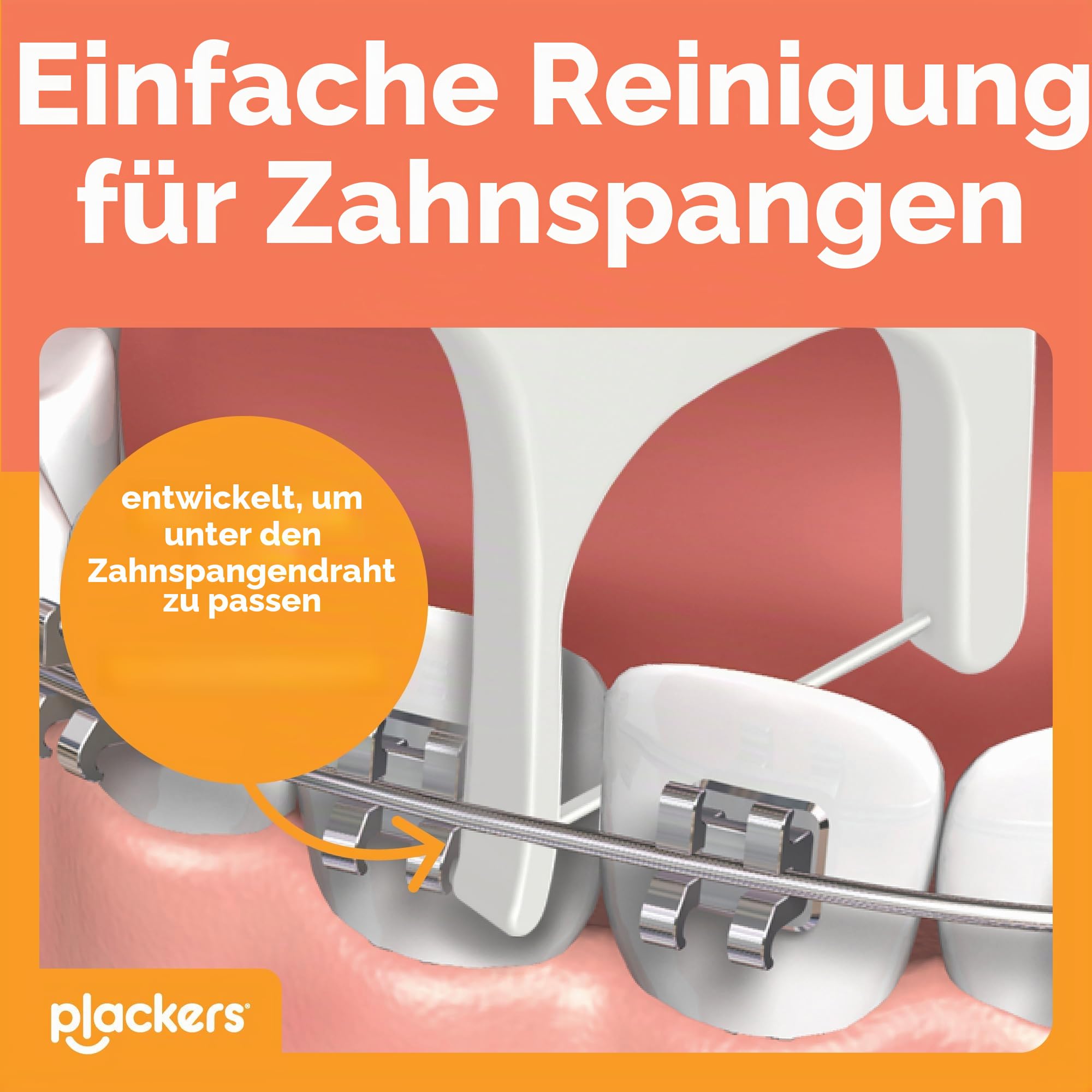 Plackers Orthopick Zahnseide Picks für Hosenträger, hergestellt mit Super TufFloss, weicher, flexibler Zahnstocher, sanft zu Hosenträgern, orange, 144 Stück (4 Stück)