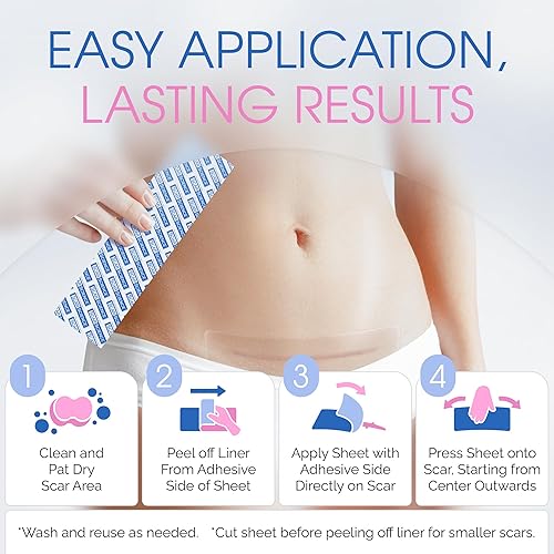 Miniatura 2 de Tiras de silicona para cicatrices de sección C para cicatrices quirúrgicas, abdominoplastia y recuperación posparto, cinta para cicatrices, hojas de