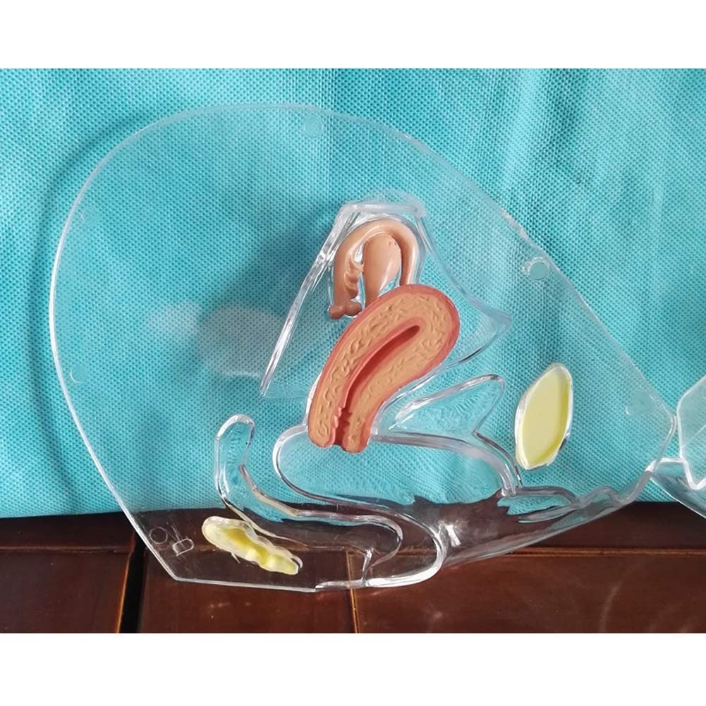 Modèle Transparent Utero Modèle pathologique Utérine Système de Reproduction médicale Modèle médical Matériel éducatif Anatomique