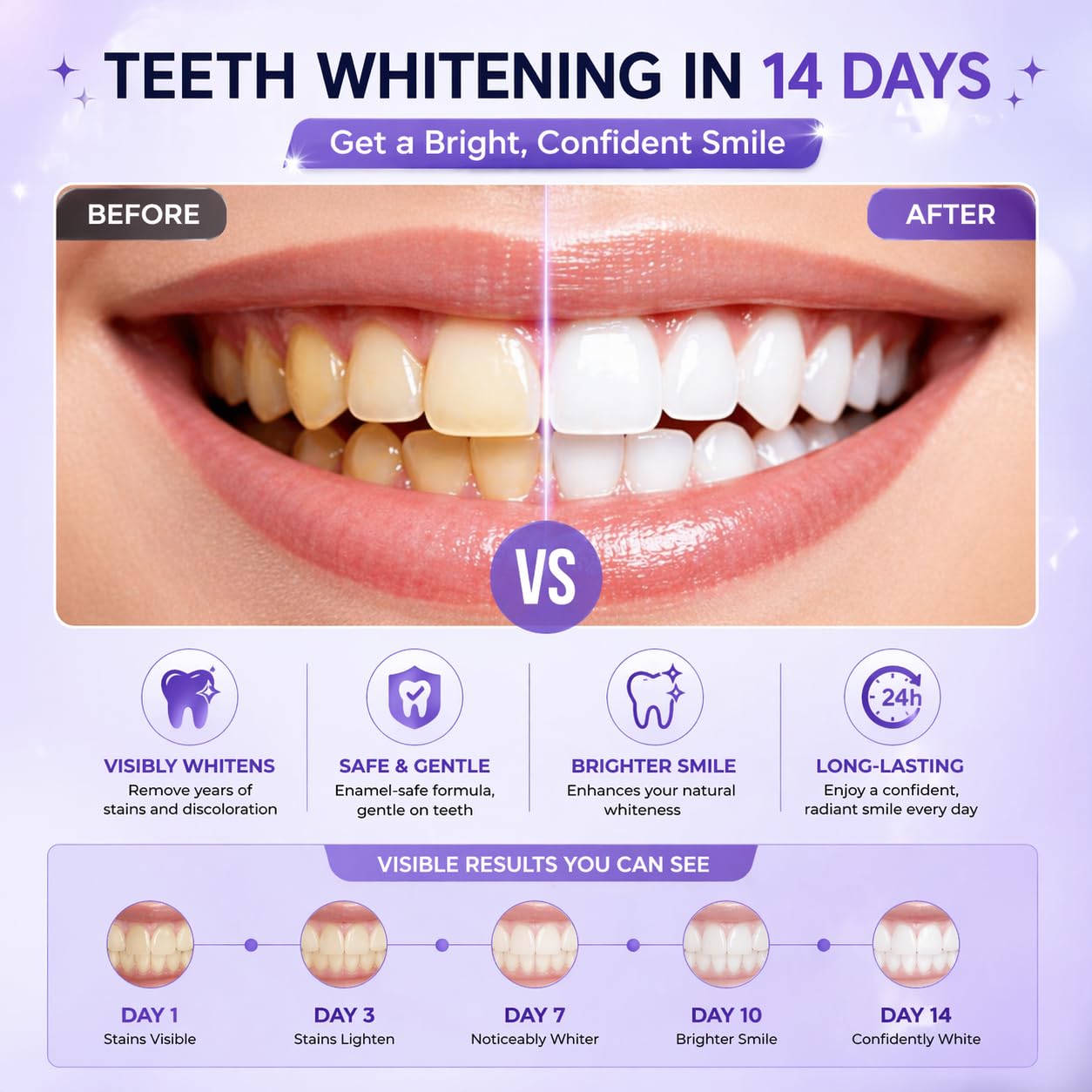 Purple Teeth Whitening Strips – V34 Color Corrector, 28 Strips (14 Treatments), Gentle Purple Whitening Strips for Teeth, Visibly Brighter Smile, Easy-to-Use Teeth Whitening Strips Purple — view 5