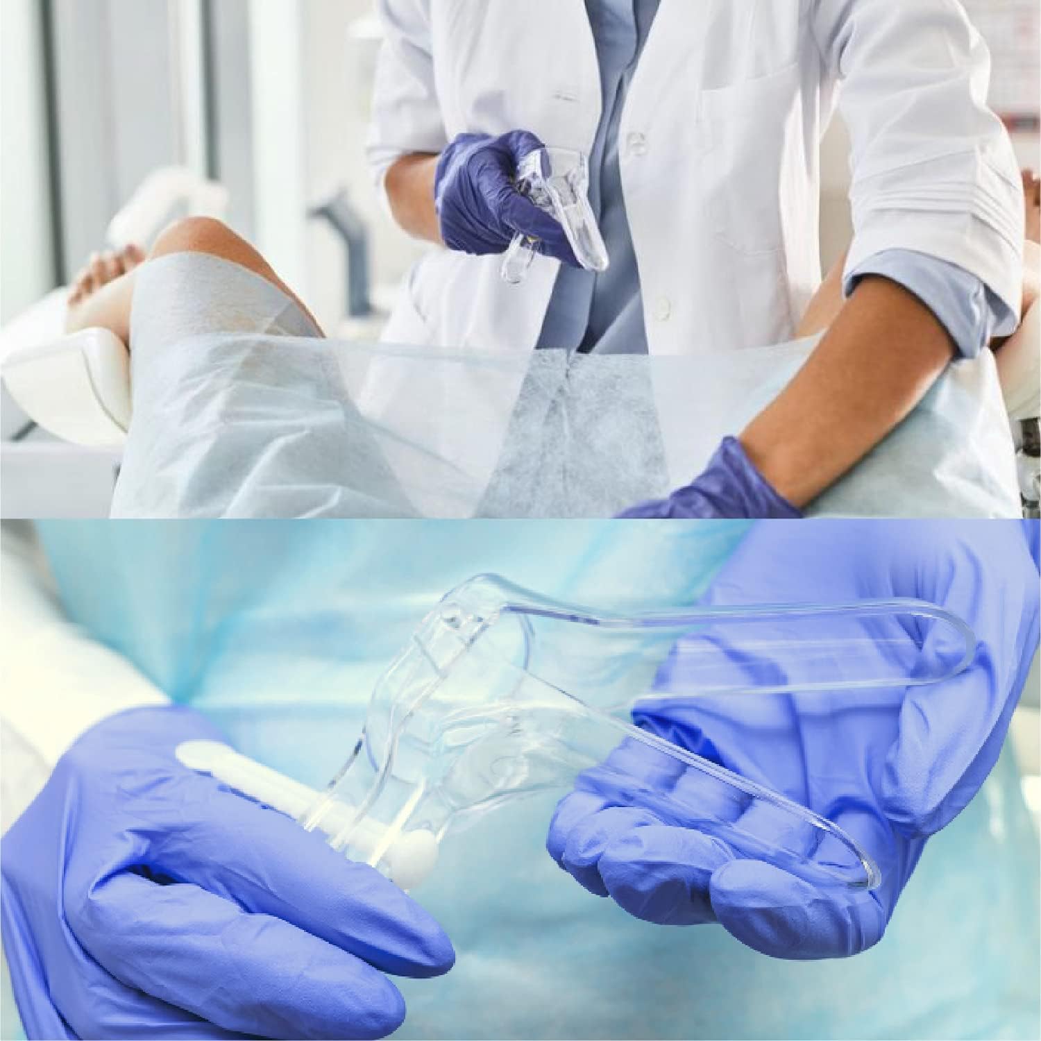 App Life Speculum Ginecologico Vaginale Monouso Sterile con Regolazione a Perno Centrale e Vite Laterale- Confezione da 100 Pezzi (Vite Laterale, S)