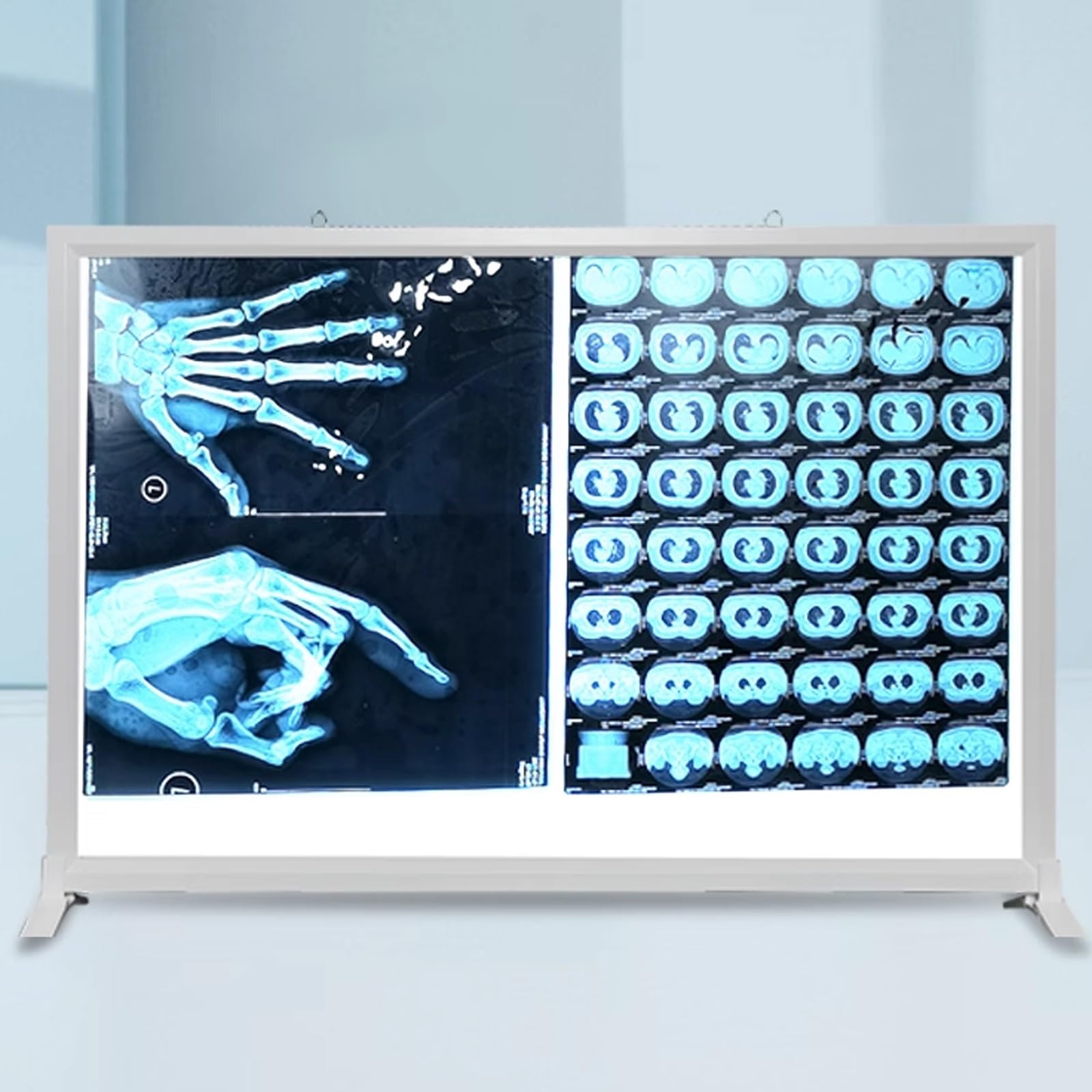 Illuminatore Pellicole Radiografiche X-ray Film Light Box 24V 41x51cm Telaio Alluminio Acrilico